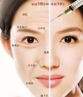https://img.miyanlife.com/mnt/timg/191219/1F93A304-1.jpg