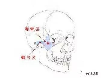 https://img.miyanlife.com/mnt/timg/191219/1FZ25100-0.jpg