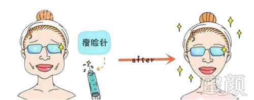 https://img.miyanlife.com/mnt/timg/191219/1G44K428-0.jpg
