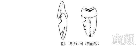 案例图片