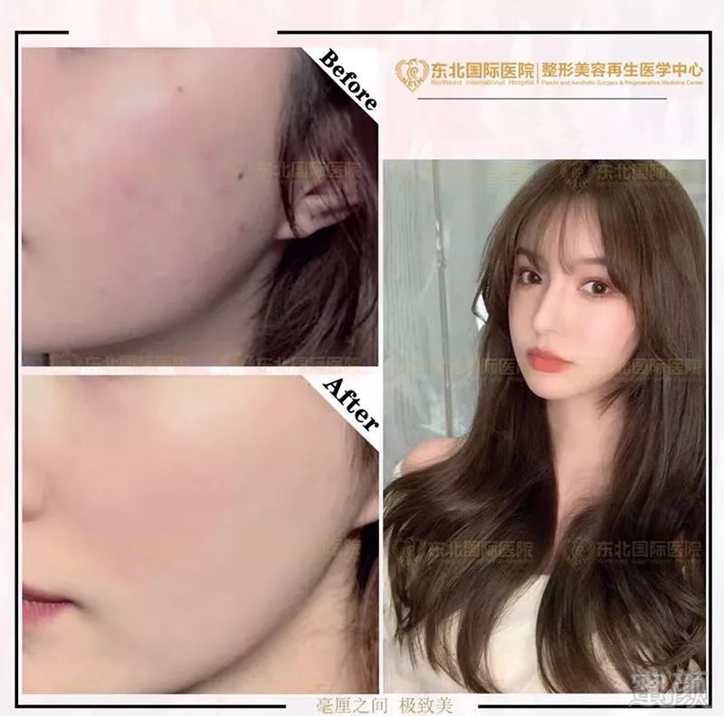 https://img.miyanlife.com/mnt/timg/191219/1R1505091-5.jpg