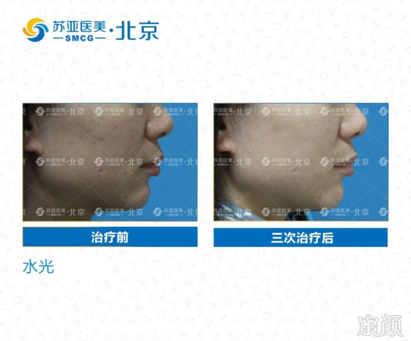 https://img.miyanlife.com/mnt/timg/191219/1R3494W5-4.jpg