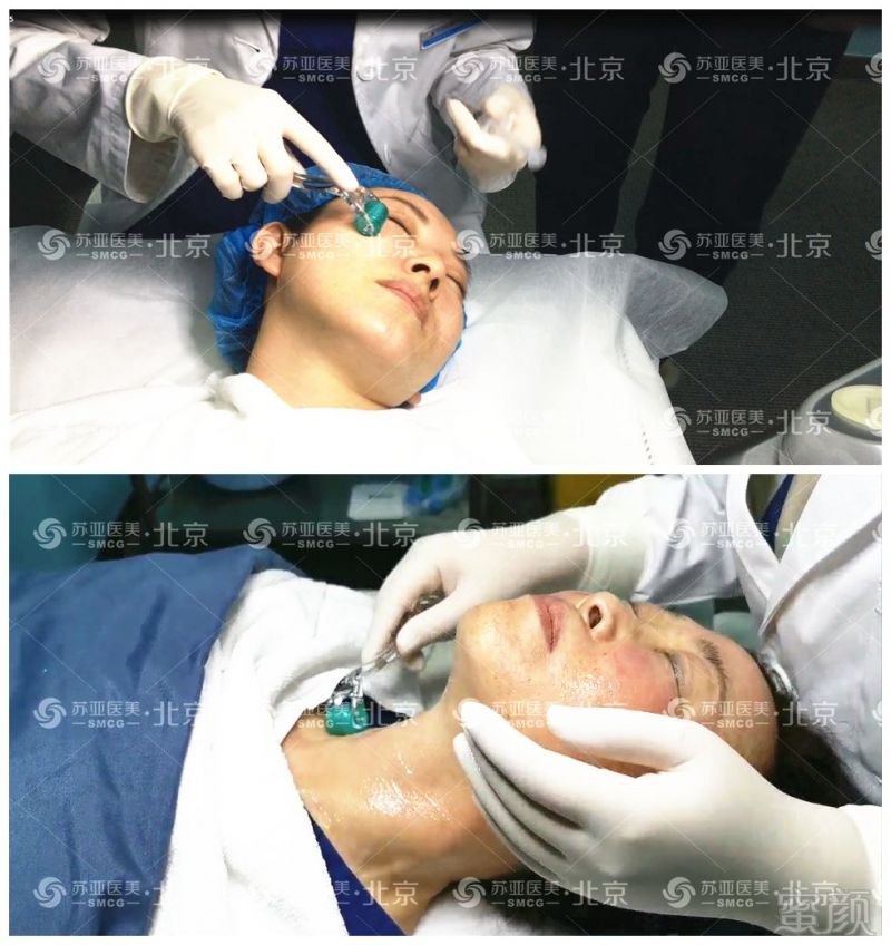 https://img.miyanlife.com/mnt/timg/191219/1R34VI9-3.jpg