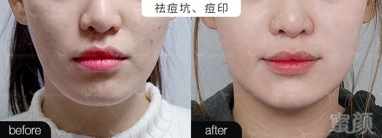 https://img.miyanlife.com/mnt/timg/191219/1R5202308-4.jpg