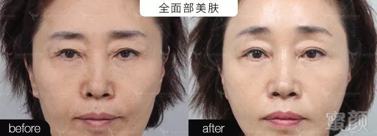 https://img.miyanlife.com/mnt/timg/191219/1R5205c1-5.jpg