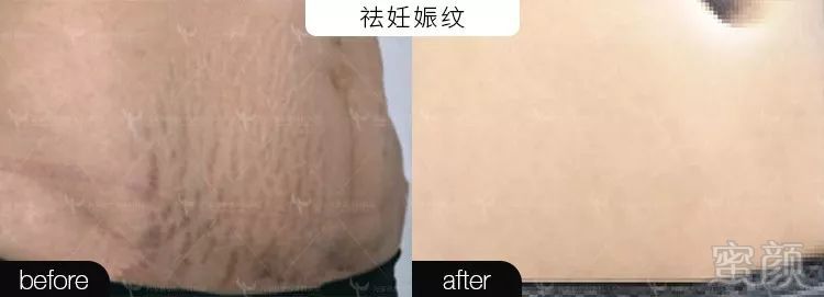 https://img.miyanlife.com/mnt/timg/191219/1R5211b2-6.jpg