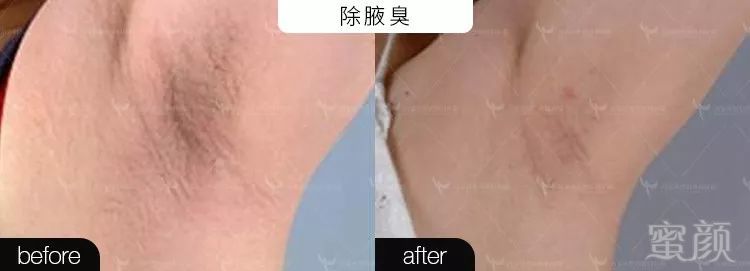 https://img.miyanlife.com/mnt/timg/191219/1R521I05-7.jpg