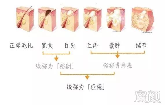 https://img.miyanlife.com/mnt/timg/191219/1S32BP0-2.jpg