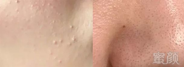 https://img.miyanlife.com/mnt/timg/191219/1S32LU4-3.jpg