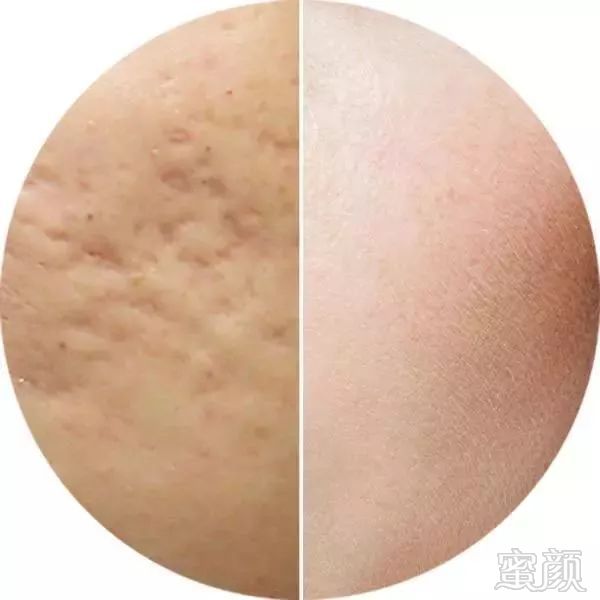 https://img.miyanlife.com/mnt/timg/191219/1S32a243-5.jpg