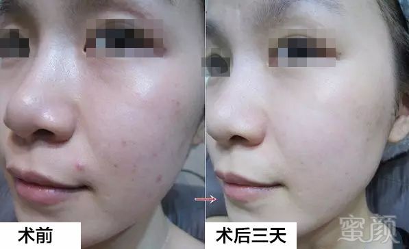 https://img.miyanlife.com/mnt/timg/191219/1S52M459-9.jpg