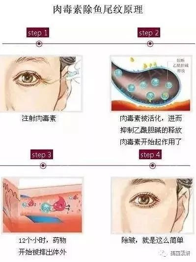 https://img.miyanlife.com/mnt/timg/191219/1T6003396-9.jpg