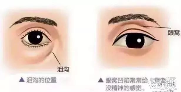https://img.miyanlife.com/mnt/timg/191219/1T60054N-10.jpg