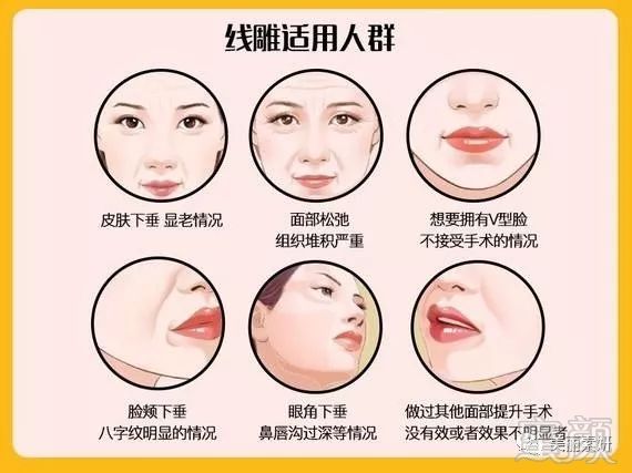 https://img.miyanlife.com/mnt/timg/191219/1T6015454-12.jpg