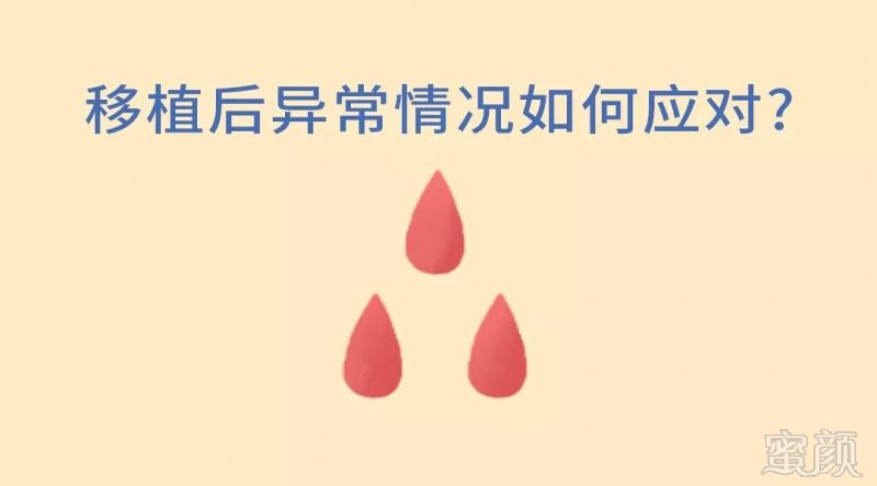 https://img.miyanlife.com/mnt/timg/191220/1350334S7-7.jpg