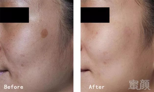 https://img.miyanlife.com/mnt/timg/191220/141JK062-8.jpg