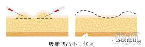 https://img.miyanlife.com/mnt/timg/191220/1453392594-1.jpg