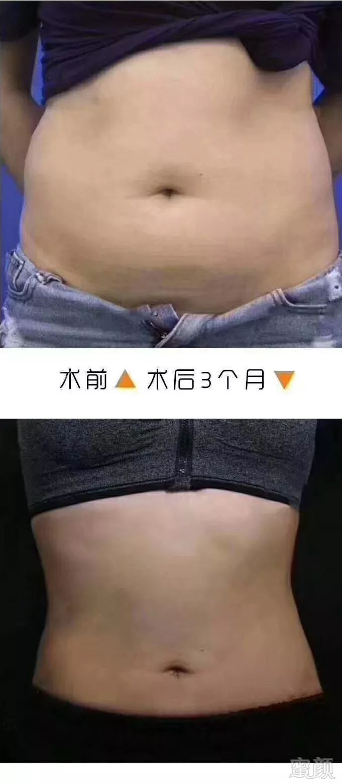https://img.miyanlife.com/mnt/timg/191220/145533B05-0.jpg