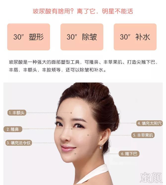 https://img.miyanlife.com/mnt/timg/191220/145G322a-4.jpg