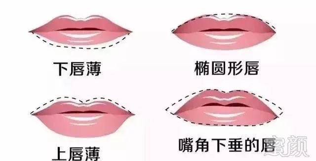 https://img.miyanlife.com/mnt/timg/191220/1510042E0-1.jpg