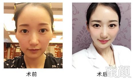 https://img.miyanlife.com/mnt/timg/191220/1510552647-4.jpg