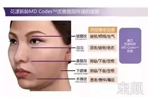 https://img.miyanlife.com/mnt/timg/191220/1510553028-3.jpg
