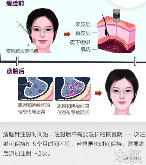 https://img.miyanlife.com/mnt/timg/191220/1513024250-1.jpg