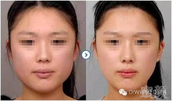 https://img.miyanlife.com/mnt/timg/191220/151510L23-6.jpg