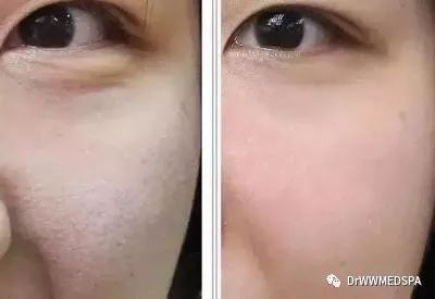 https://img.miyanlife.com/mnt/timg/191220/1515143095-14.jpg