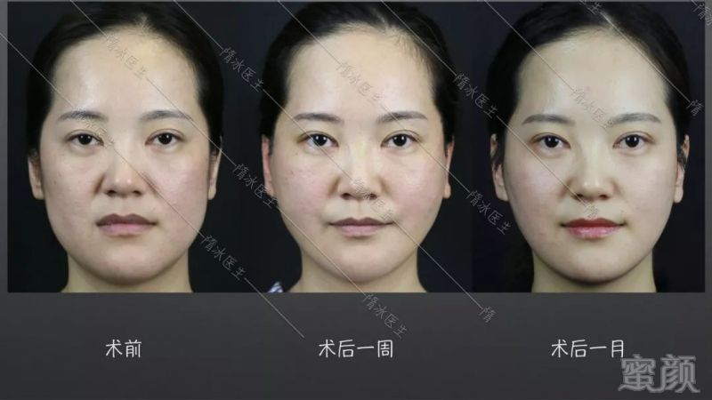 https://img.miyanlife.com/mnt/timg/191220/151913J52-3.jpg