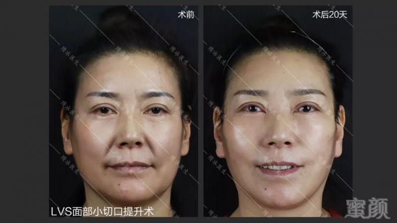 https://img.miyanlife.com/mnt/timg/191220/1519155344-5.jpg