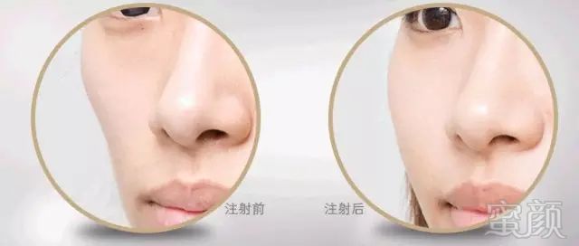 https://img.miyanlife.com/mnt/timg/191220/151F0D09-6.jpg