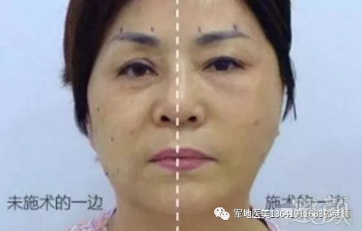 https://img.miyanlife.com/mnt/timg/191220/151Q5K55-0.jpg