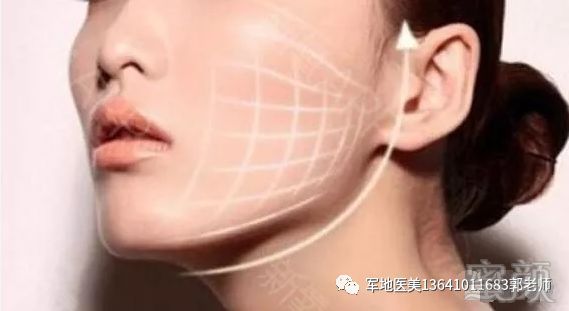 https://img.miyanlife.com/mnt/timg/191220/151QI108-5.jpg