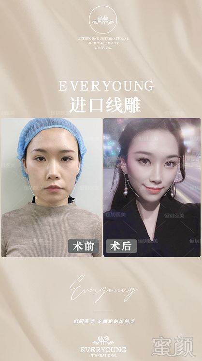 https://img.miyanlife.com/mnt/timg/191220/1544303325-6.jpg