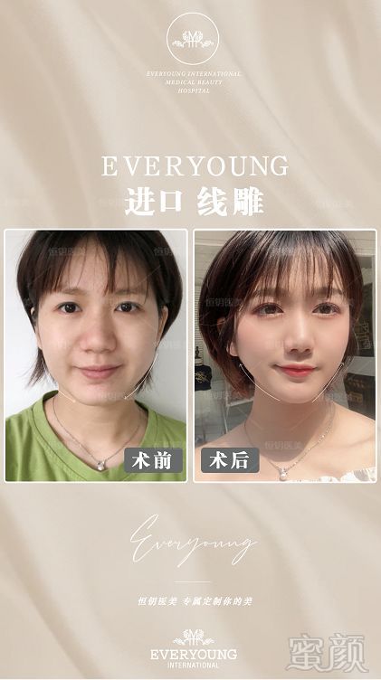 https://img.miyanlife.com/mnt/timg/191220/1544303V2-5.jpg
