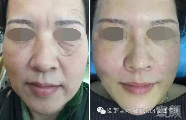 https://img.miyanlife.com/mnt/timg/191220/15460260Q-2.jpg