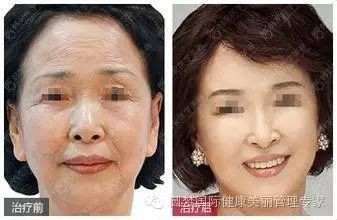 https://img.miyanlife.com/mnt/timg/191220/15460264O-1.jpg