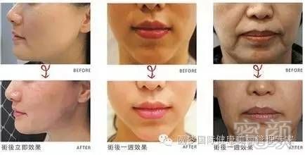 https://img.miyanlife.com/mnt/timg/191220/1546032156-5.jpg