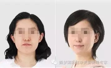 https://img.miyanlife.com/mnt/timg/191220/15460343T-6.jpg