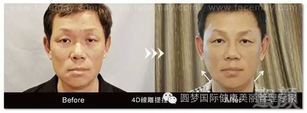 https://img.miyanlife.com/mnt/timg/191220/1546045064-7.jpg