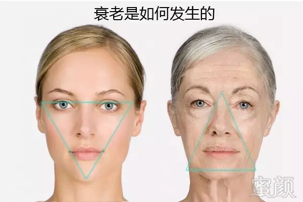 https://img.miyanlife.com/mnt/timg/191220/16045614H-4.jpg