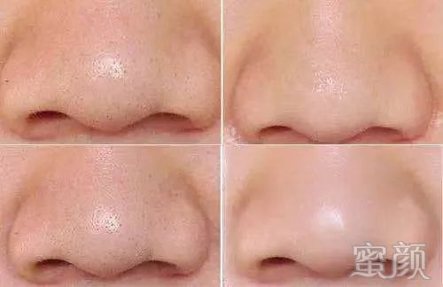 https://img.miyanlife.com/mnt/timg/191221/12220M317-12.jpg