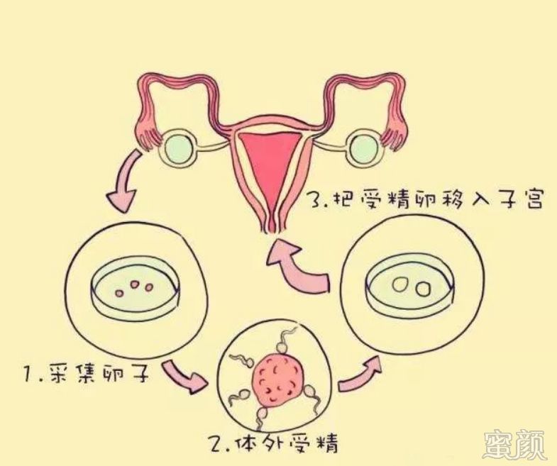 https://img.miyanlife.com/mnt/timg/191221/1232134c7-1.jpg