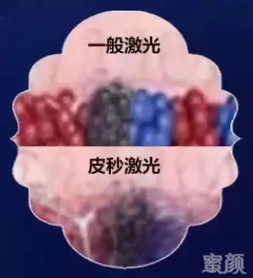 https://img.miyanlife.com/mnt/timg/191221/12525461S-2.jpg