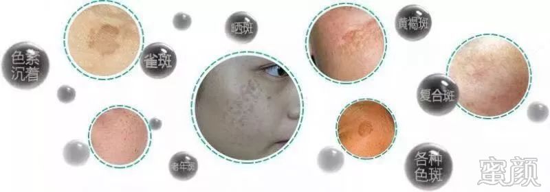 https://img.miyanlife.com/mnt/timg/191221/1256195419-2.jpg