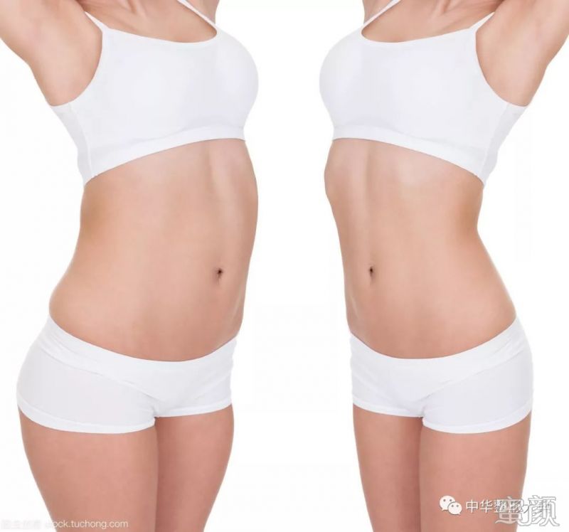 https://img.miyanlife.com/mnt/timg/191221/1345501135-2.jpg