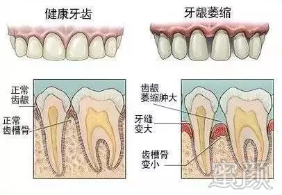 https://img.miyanlife.com/mnt/timg/191221/140S043J-1.jpg