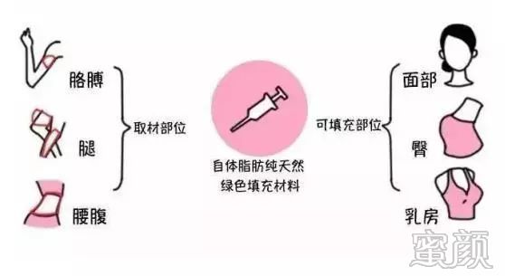 https://img.miyanlife.com/mnt/timg/191222/134T61547-5.jpg