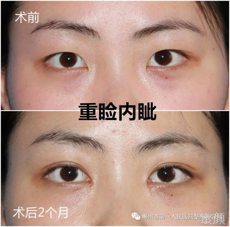 https://img.miyanlife.com/mnt/timg/191223/1911564M8-4.jpg